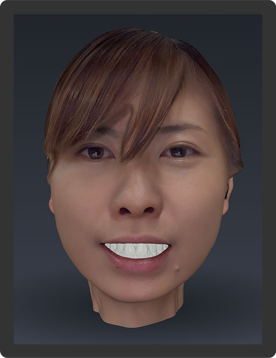 Realistic Face Scanning for Dental Applications