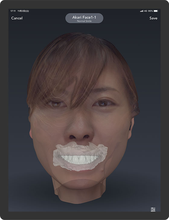 Realistic Face Scanning for Dental Applications