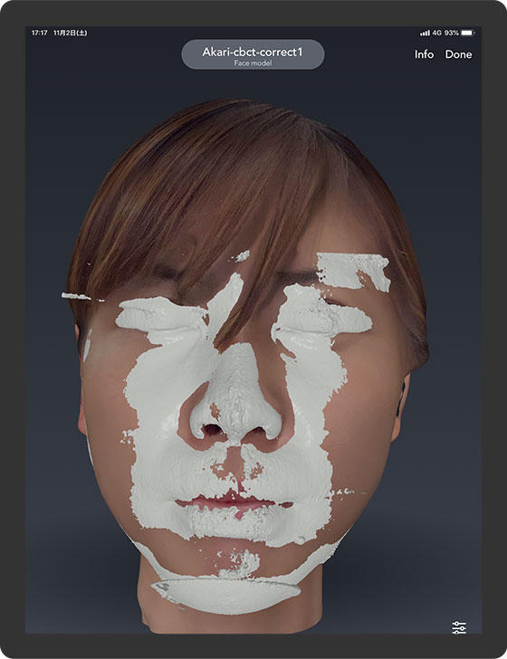Realistic Face Scanning for Dental Applications