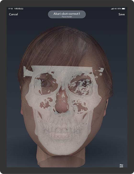 Realistic Face Scanning for Dental Applications