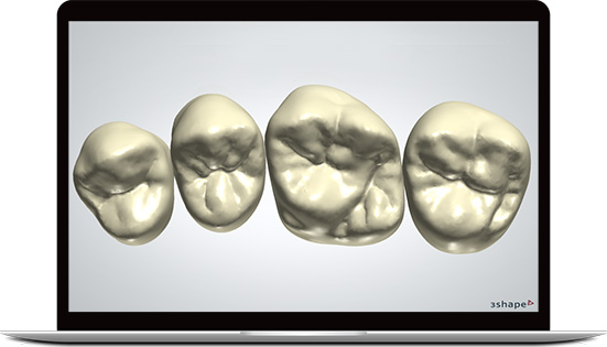 Tooth library for 3shape / exo cad